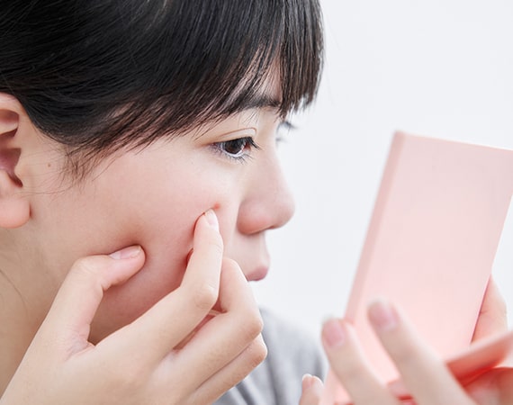Microdermabrasion Effective for Acne