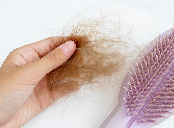 Alopecia areata (bald patches):